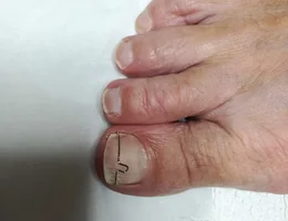 Gespecialiseerde Pedicure Eline