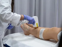 BHC Aesthétic - Epilation définitive au laser à Uccle