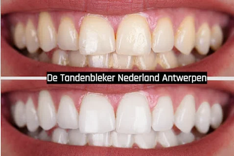 Photo De Tandenbleker Nederland Antwerpen